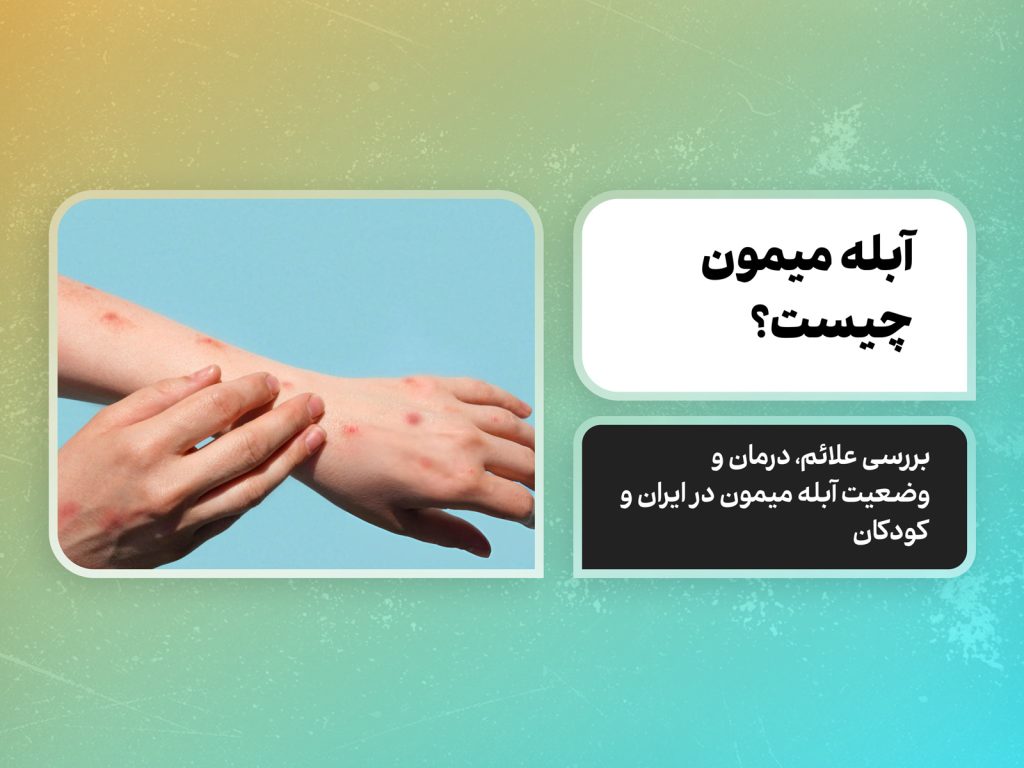 آبله میمون چیست؟ بررسی علائم، درمان و وضعیت آبله میمون در ایران و کودکان